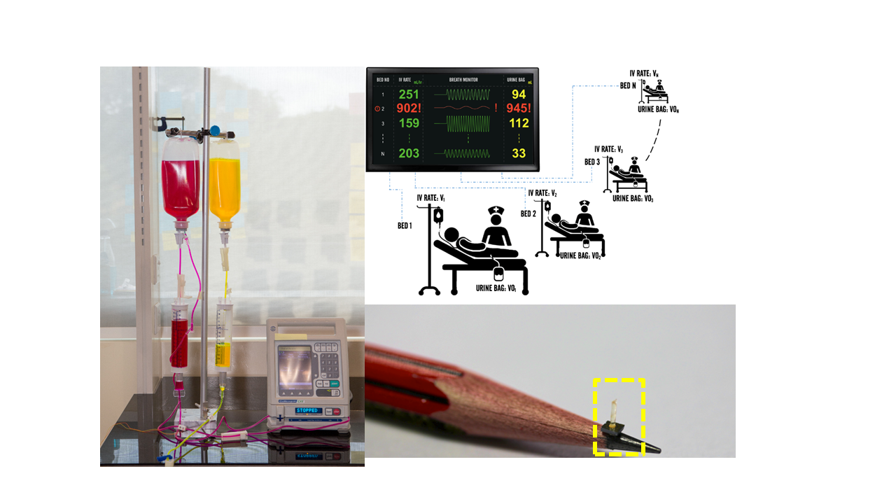 flow sensors for safer intravenous (IV) infusion therapy